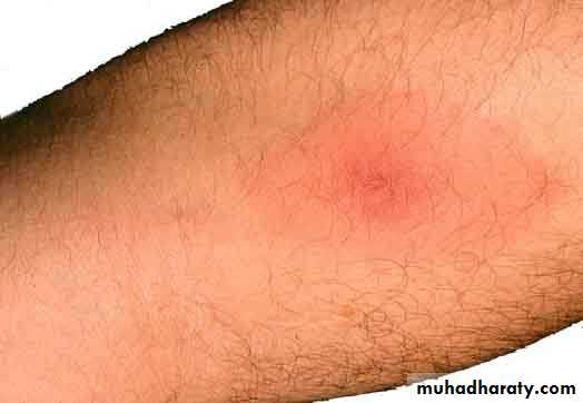 Hemoflagella Trypanosomiasis Pptx - Dr Sarab - Muhadharaty