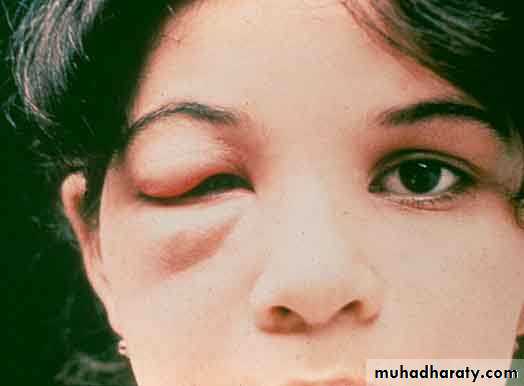 Hemoflagella Trypanosomiasis Pptx - Dr Sarab - Muhadharaty