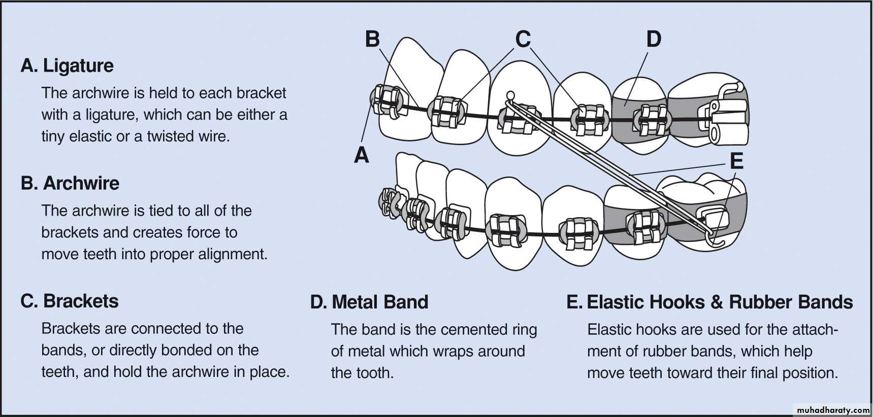 Fixed orthodontic appliances pptx Dr.Hakam Muhadharaty