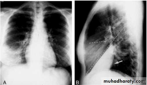 chest practice pptx د احمد muhadharaty