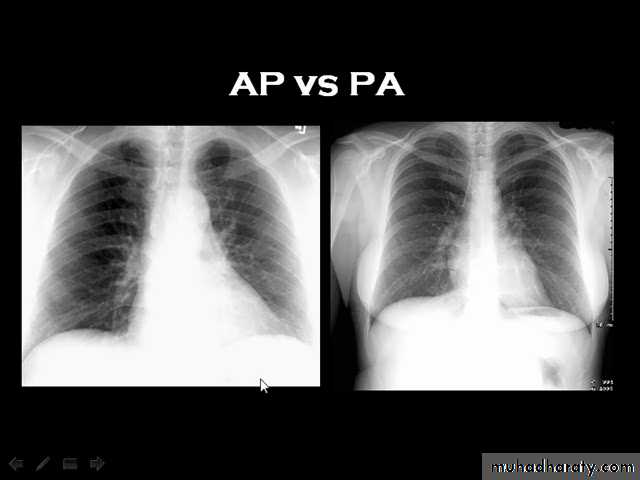 chest practice pptx - د.احمد - Muhadharaty