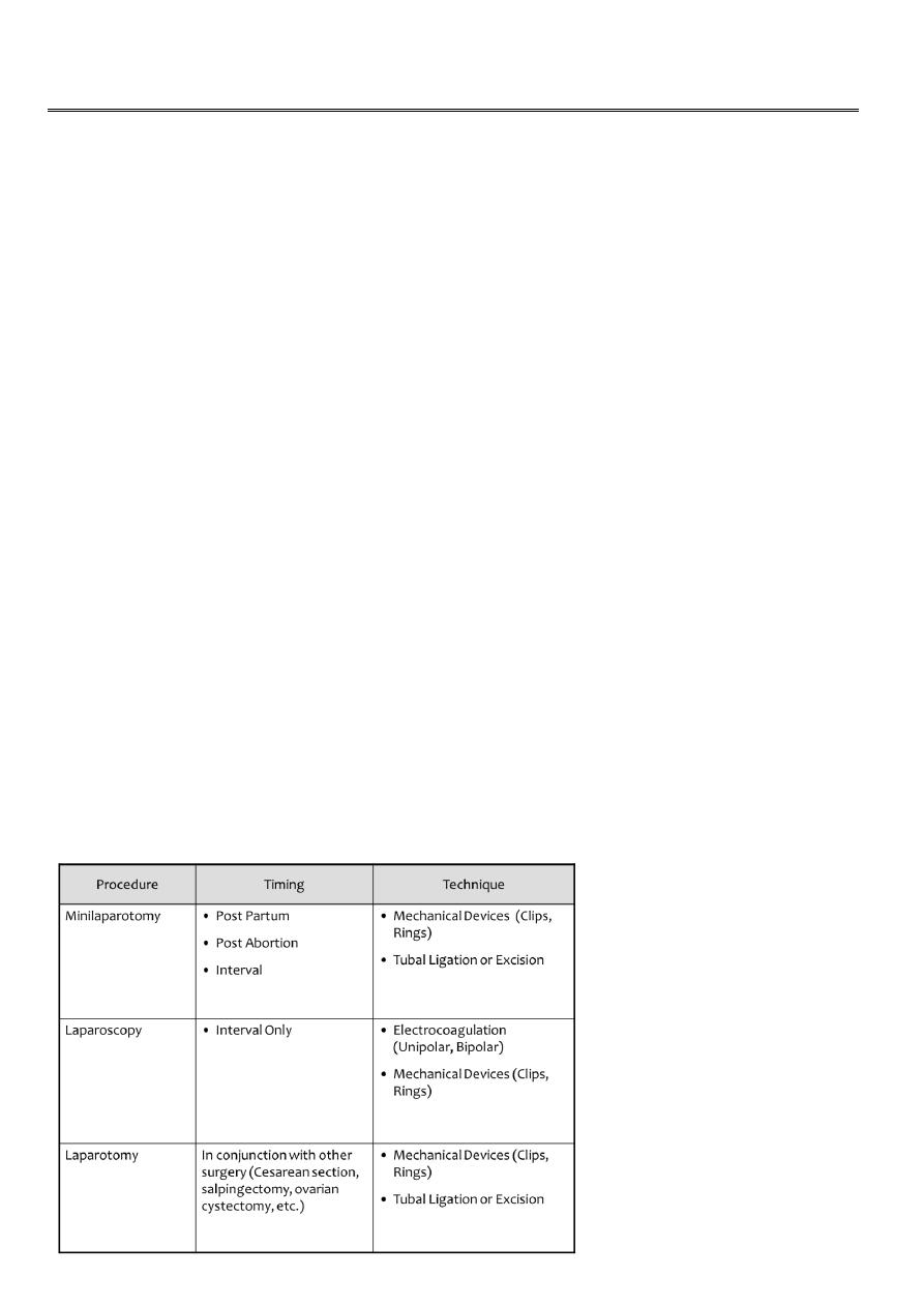 Procedure Information Sheet- Laparoscopic Tubal Occlusion
