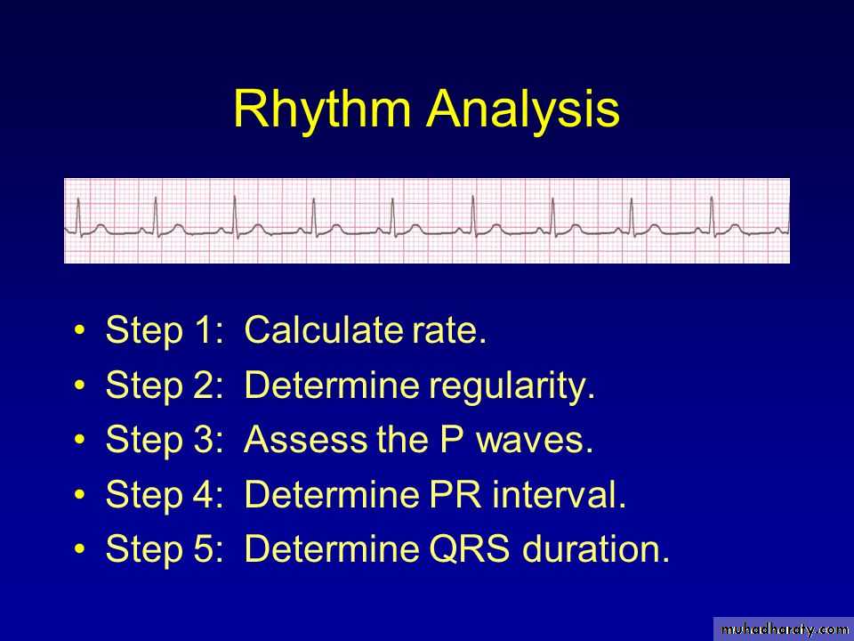 Irregular pulse interval