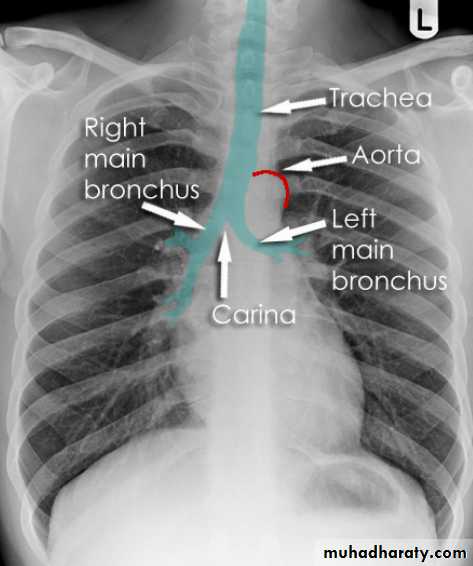 Chest Imaging docx - Chest Imaging - Muhadharaty