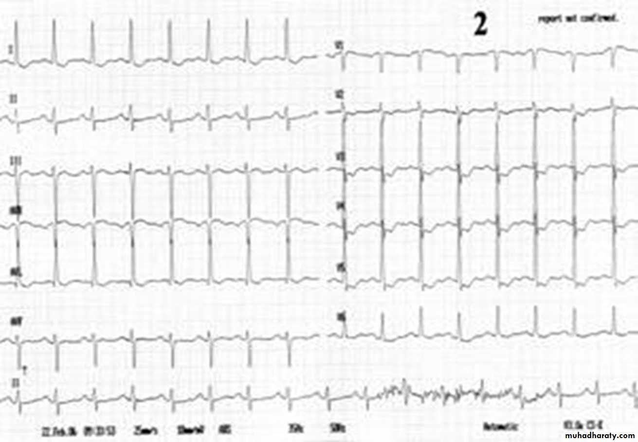 Cardio L4