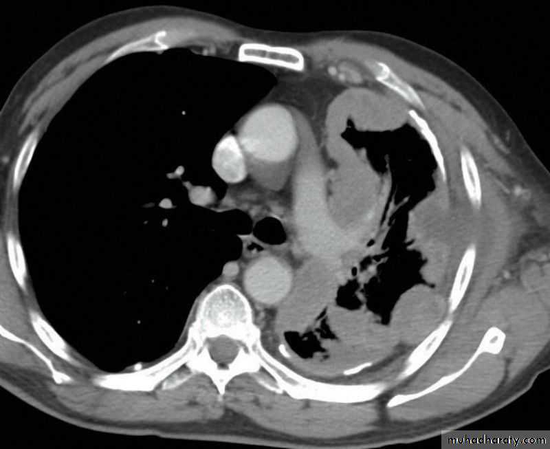 vacular and chest pptx - كروب c - Muhadharaty