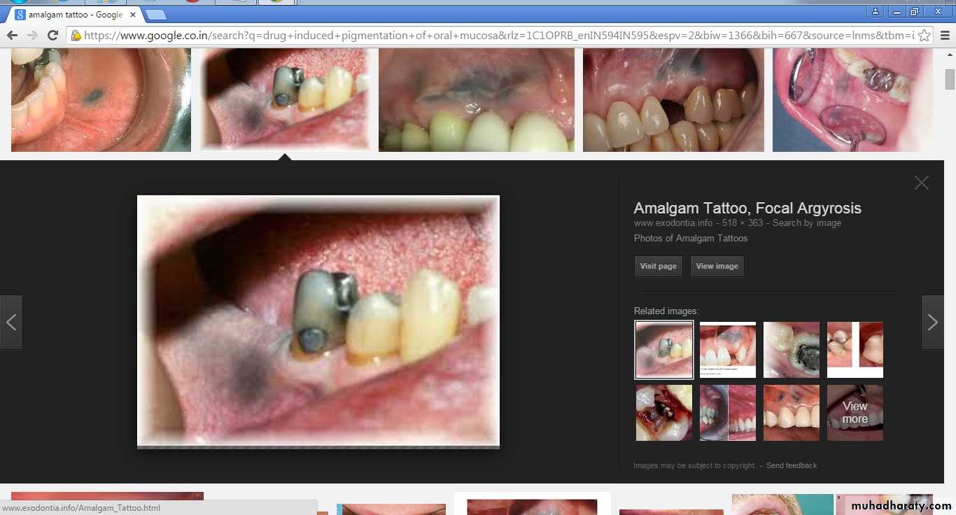 26 Oral Pathology. - ppt video online download