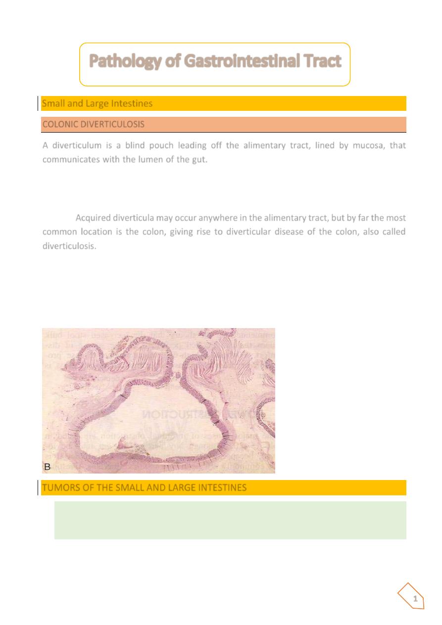 Pathoma 10.8b Colorectal Cancer Flashcards | Quizlet