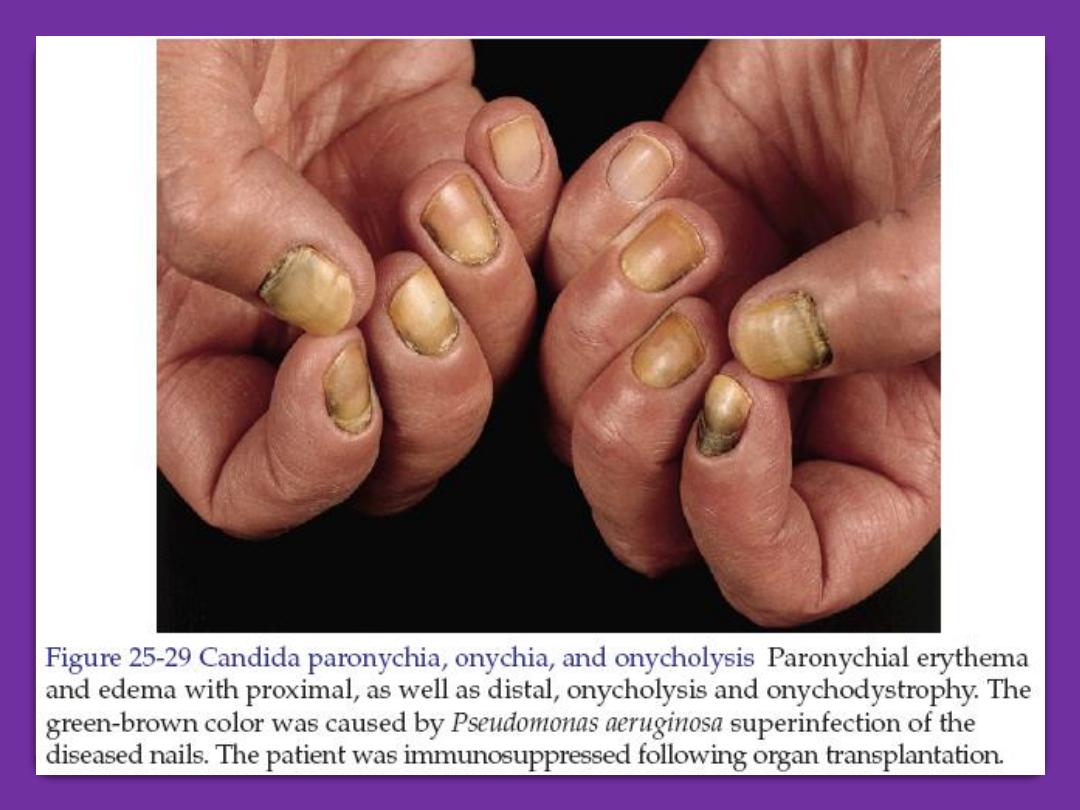 Treatment Outline for Common Nail Problems | SpringerLink