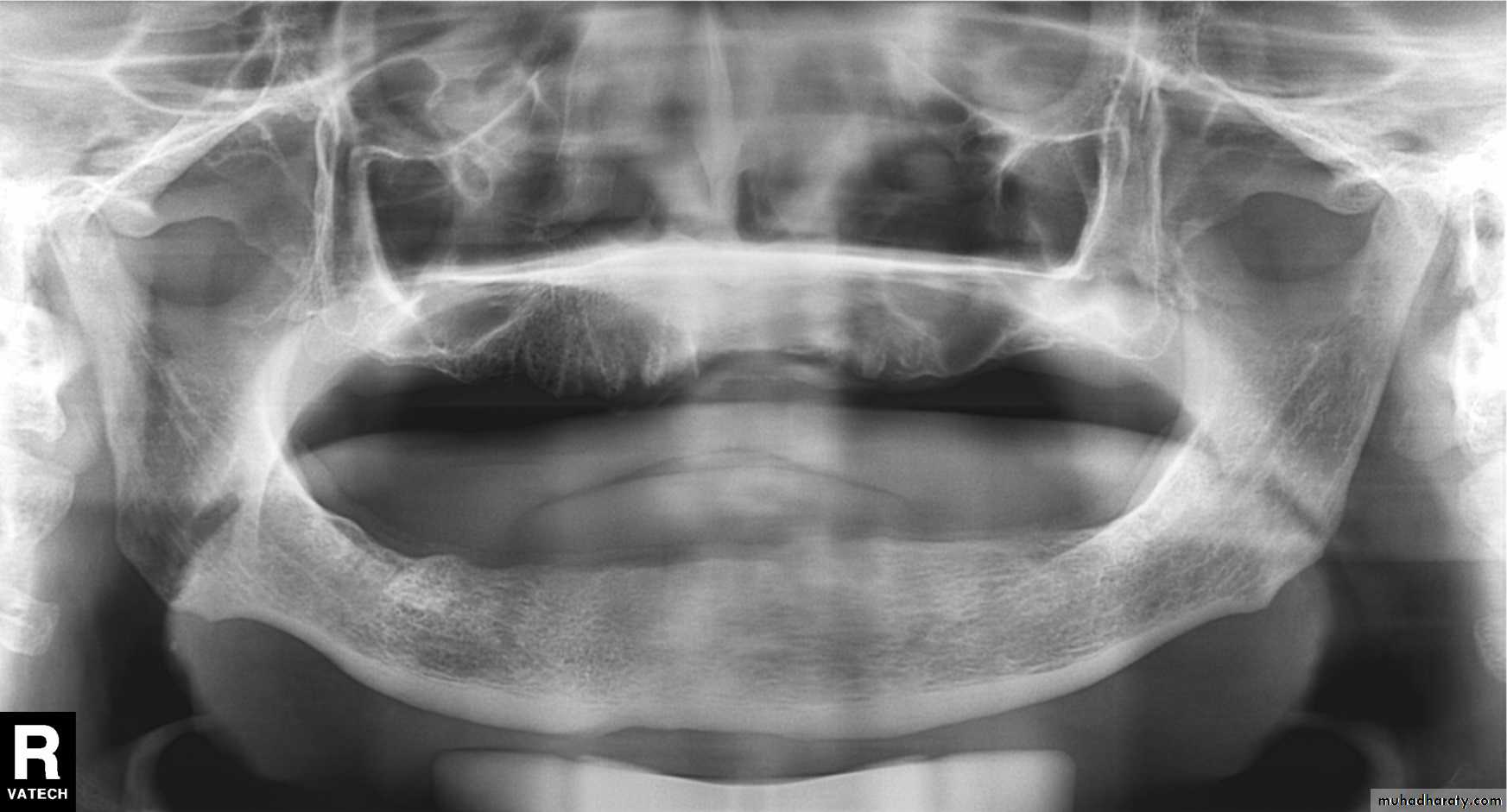 Panoramic Radiography pptx - Dr.Rand - Muhadharaty