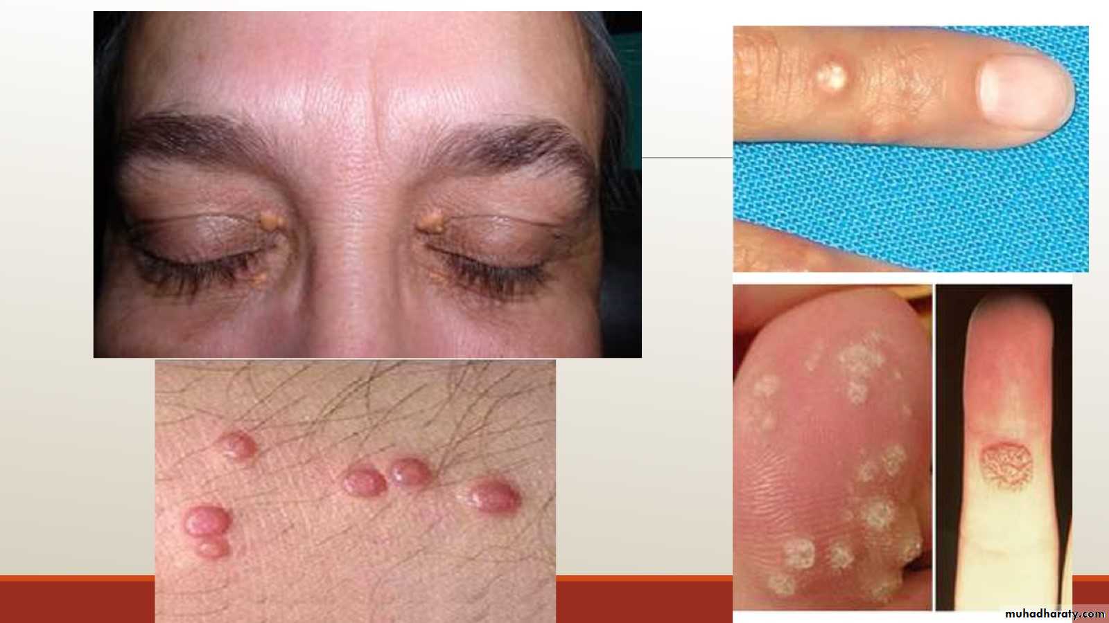 Diagnosis Of Skin Diseases Pptx D Hadf Muhadharaty