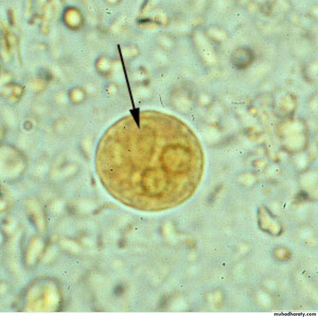 Простейшие в кале лечение. Цисты Entamoeba. Цисты лямблии микроскопия. Цисты лямблий микроскопия. Микроскопия кала цисты амеба.