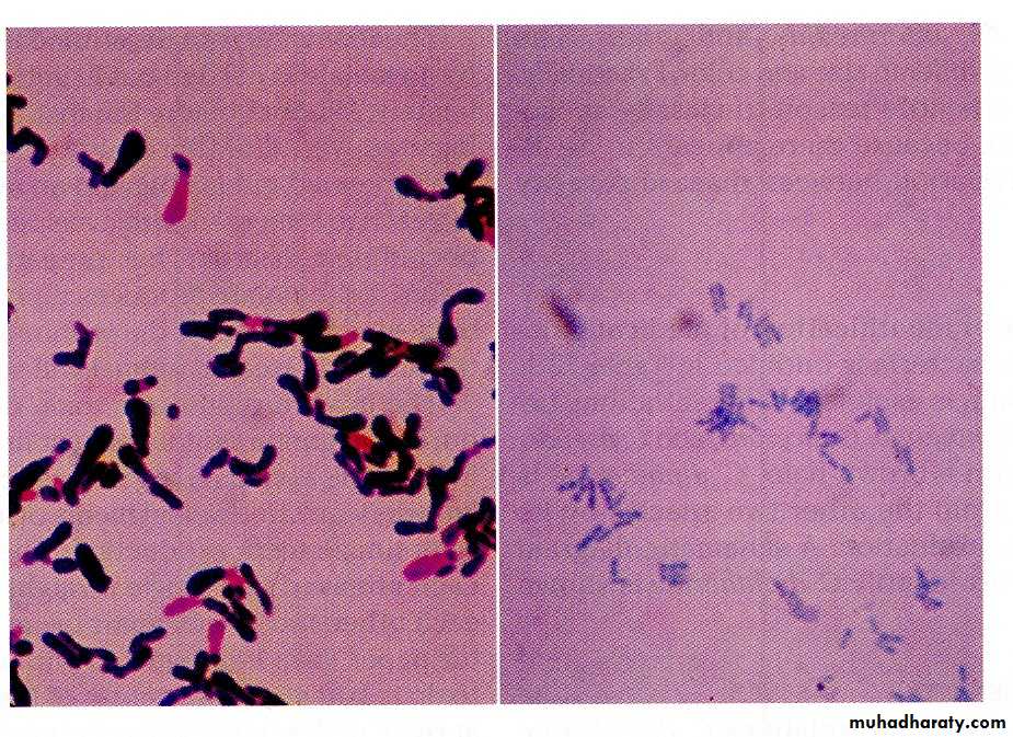 Cornyebacterium diphtheriae pptx - د. غادة يونس - Muhadharaty