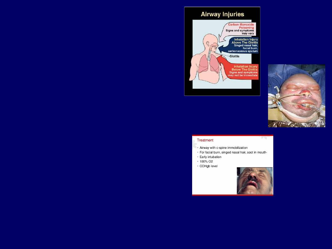Electric Injuries pdf - All Lectures - Muhadharaty Electric Injuries pdf - All Lectures - Muhadharaty