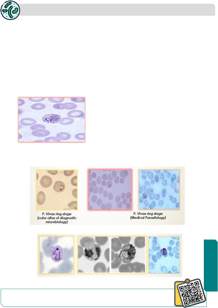 Unusual presentation of Plasmodium vivax: a neglected human malaria  parasite | Parasitology Research